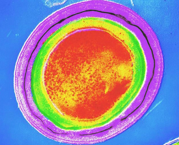 Clostridium tetani spore