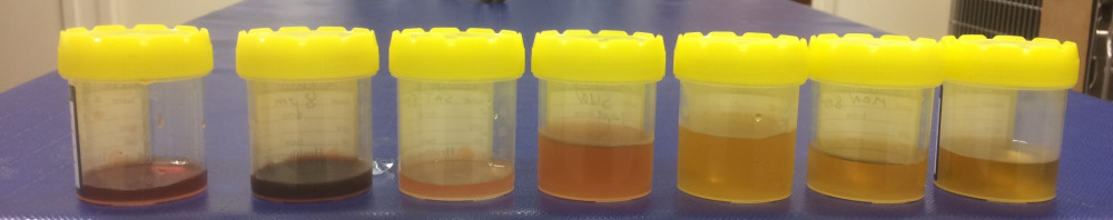 Urine sample sequence